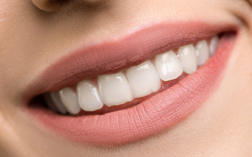 Faccette dentali - Odontoiatria estetica Piombino